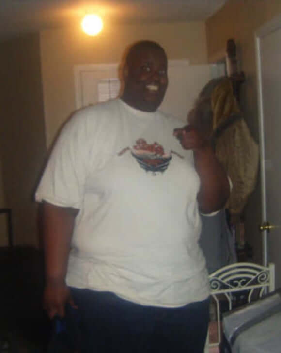 Kelvin Before picture